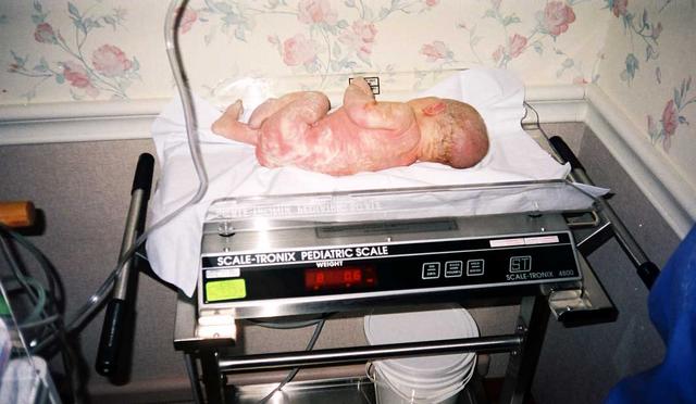 Jacob's weight at birth: 8 pounds, 0.6 ounces