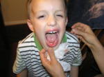 Highlight for Album: Jacob Loses His First Tooth